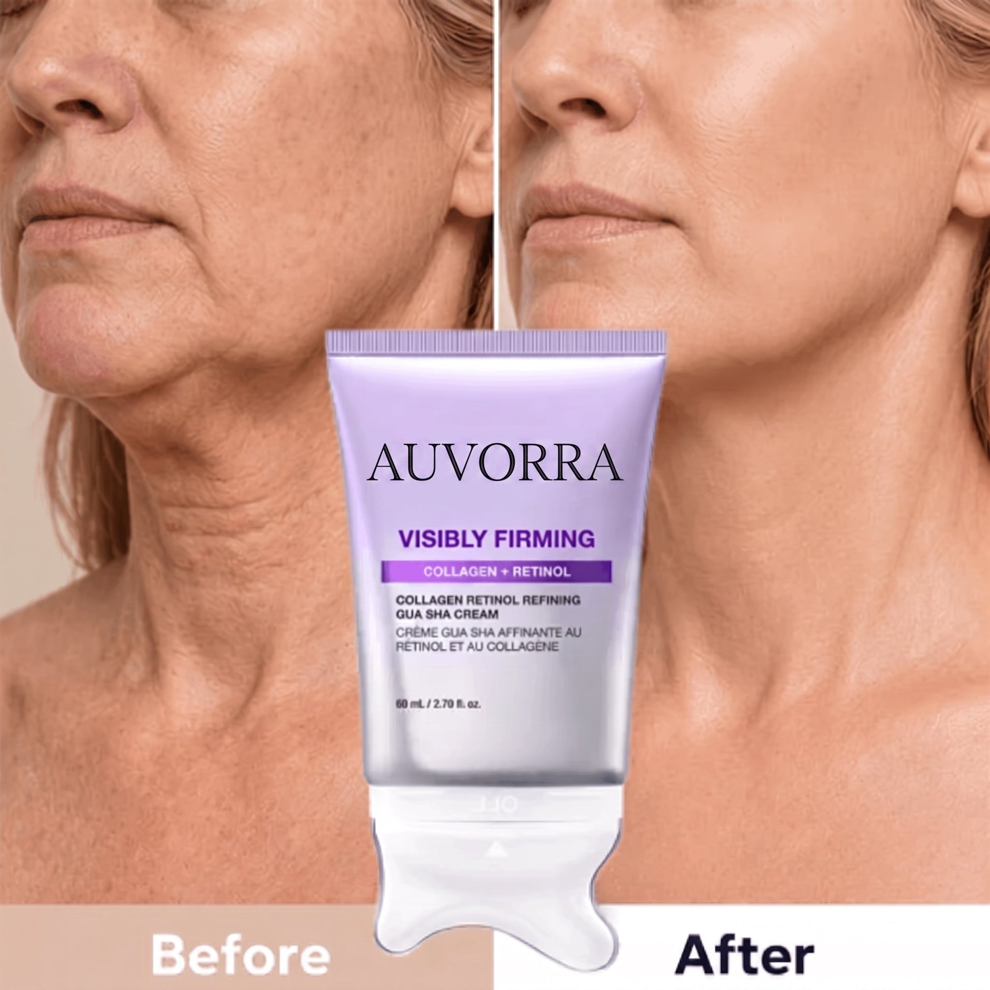 Before and after firming results