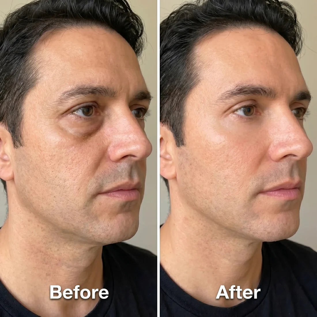 Auvorra Lymphatic Face Brush
