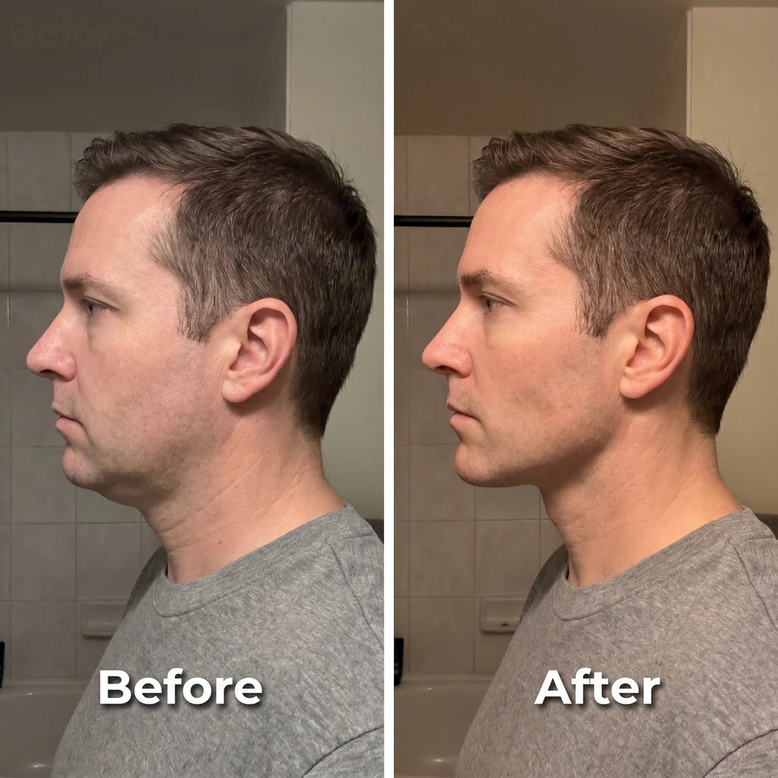 Auvorra Lymphatic Face Brush