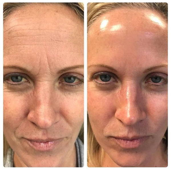 Laura M., 47